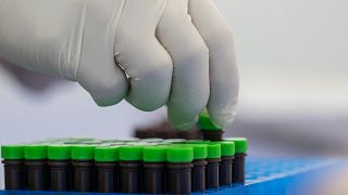 WHO says the mpox outbreak remains a public health concern