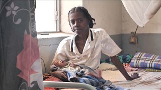 Malnutrition in mothers soars in 12 countries, putting women and babies at risk - UNICEF